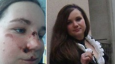 Záhada! Terezu (28) našli v kaluži krve. Nepamatuje si, co se stalo