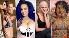 Nejošklivější ženy světa: Bez ostychu popsaly své příběhy