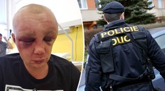 Policie zná totožnost útočníků na mladého vojáka! Přihlásili se sami