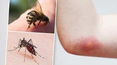 Alergici mají pohotovost. Nebezpečný hmyz je velmi aktivní