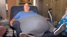Děsivé! Muži (63) roste z břicha nádor, který váží STO KILO!