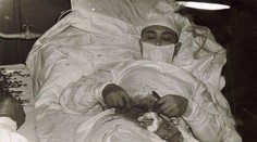 Neuvěřitelný zákrok! Lékař si sám vyoperoval slepé střevo. FOTKY