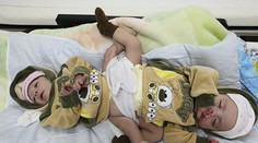 Rozdělení lidského pavouka! Neskutečné fotky přímo ze sálu