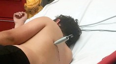 Hra na trampolíně se změnila v horor! Chlapec skončil s pružinou v zádech