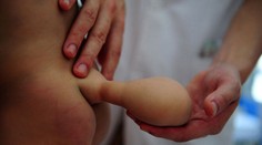 Nešťastná matka prosí lékaře: Odstraňte mému dítěti ocas!