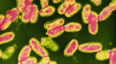 Tuberkulóza je ve světě opět na vzestupu, může za to pandemie covidu-19