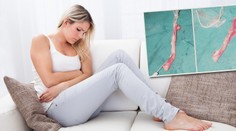 Žena šla k lékaři s bolestí břicha. Co jí našli ve slepáku, je šokovalo
