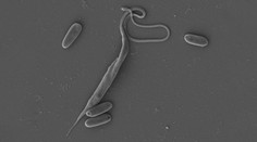 Český parazit má neobvyklý DNA kód. Je jako diktát nepozorného žáka, řekl biolog