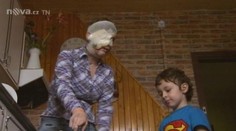 Rakovina vzala Daně (38) půlku obličeje, ale nevzala jí touhu pomáhat dětem