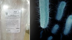 Další problém v Dubí! Kvůli salmonele zavřeli prodejnu kebabu