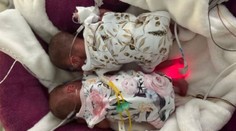 Malý zázrak v Praze. Narodila se tam jen půlkilová dvojčata, daří se jim dobře