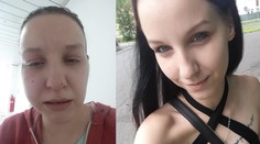 Žena řeší zničené zuby s klinikou, na hororového zubaře podala stížnost