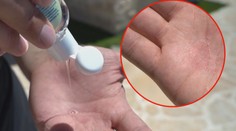 Pozor na dezinfekci! Na sluníčku vám může i ublížit