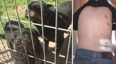 Chlapec pokousaný rotvajlery se pomalu zotavuje. AGRESIVNÍ psi můžou útočit dál!