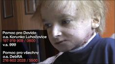 POMOC OBYČEJNÝCH LIDÍ! Poslali statisíce chlapci s těžkou nemocí