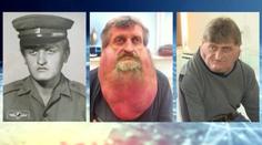 Příběh Slováka s nádorem obletěl svět! Pod krkem měl 6 kilo tuku