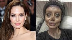 Měla vypadat jako Angelina Jolie. Takhle po 50 operacích dopadla!
