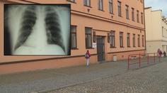 Učitel v Polné měl tuberkulózu! Ve škole mohl nakazit 250 dětí