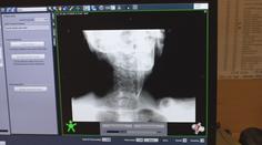 V Česku proběhl den proti rakovině. Počet pacientů roste, lékaři cílí na prevenci