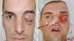 Hrůzné foto: Hádejte, proč si tento muž prostřelil hlavu a jak dopadl