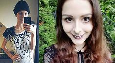 Julie trpěla anorexií. Aby nemusela jíst, schovávala si jídlo do uší