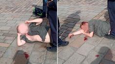 Polonahý agresor útočil na strážnici, skončil se zkrvavenou hlavou!