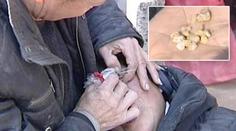 Pláč ženě působí muka: Místo slz brečí kameny! FOTO PRO OTRLÉ