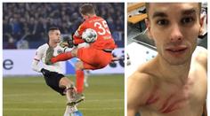 Faul roku! Brankář v bundeslize podrážkou ocejchoval útočníka