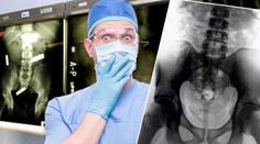 Šílená GALERIE: Tohle všechno už doktoři našli lidem v žaludku!