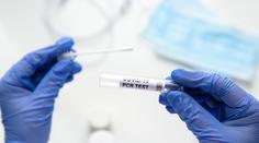 Za sobotu přibylo 9 210 nově nakažených, ubylo ale hospitalizovaných