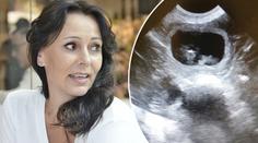 Heidi čeká přírůstek do rodiny! Pochlubila se fotkou z ultrazvuku