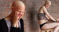 Melánie (25) nemá vlasy ani krásnou tvář, a přece je modelkou