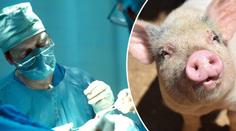 Lékaři hlásí průlom v transplantacích, žena dostala ledvinu z prasete