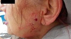 Kluci (12 a 17) stříleli vzduchovkou po seniorce, trefili ji do tváře