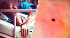 Nejhorší čísla za deset let. Klíšťata šíří nebezpečné nemoci, očkovaných je málo