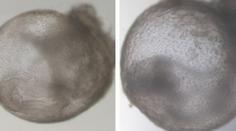 Přelom ve vědě. Výzkumníci vypěstovali první umělé embryo bez spermie i vajíčka