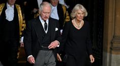 Strach o zdraví Karla III. Král má zarudlé ruce a silně oteklé prsty