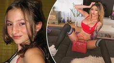Z ošklivky hvězdou instagramu: Mnoho plastik má smutný důvod
