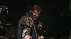 Šokující fotografie ukrajinského zajatce. Ztratil 30 procent váhy