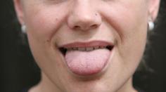Co všechno můžete vyčíst z jazyka? Důležitá je barva a tvar