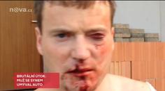 Muže zmlátili za to, že se s nimi nechtěl bavit. Hrozí jim 10 let