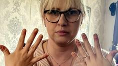 FOTO: Žena léta nosila gelové nehty. Teď toho hořce lituje