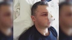 Mladík měl brutálně zbít hasiče. "Myslel, že je otravuje," tvrdí otec