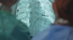 Poruchy srdce trápí stále častěji i mladé lidi. Pomoct může operace