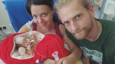 Sofinka prodělala obrnu a potřebuje rehabilitace. Pomáhají Dobří andělé