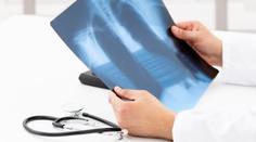 Průlom v boji s rakovinou plic? Vědci chystají preventivní vakcínu