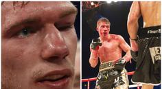 Hrozivý pohled: Boxer skončil s krvácením do mozku v kómatu!
