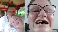 Britka si sama vytrhla 11 zubů. "Neměla jsem na zubaře a teď trpím," pláče
