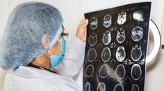 Lidé často podceňují příznaky zákeřné nemoci. Lékaři před ní důrazně varují