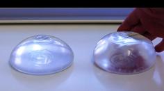 Přibývá žen s nemocí prsních implantátů. Pomohla až další operace, říkají